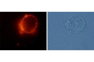 Expression of Angiotensin II receptor type-2 in rat GH3 pituitary cells - Cell surface detection of Angiotensin II receptor type-2 in live intact rat GH3 pituitary cells using Anti-Angiotensin II Receptor Type-2 (extracellular) Antibody (ABIN7042925, ABIN7043902 and ABIN7043903), (1:100), followed by goat anti-rabbit-AlexaFluor-555 secondary antibody.