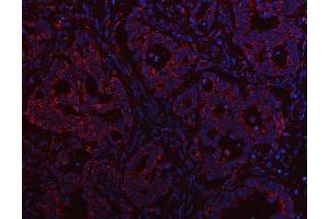 anti-Family with Sequence Similarity 82, Member A2 (FAM82A2) (AA 45-438) antibody