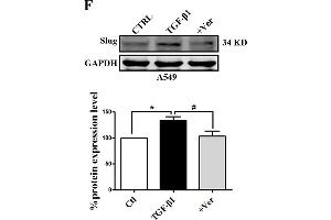 Slug is regulated by the co-transcriptional complex YAP1/TEAD in the EMT program of A549 cells. (GAPDH anticorps)