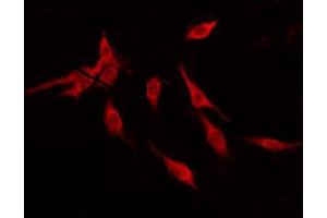 ABIN6274844 staining NIH-3T3 by IF/ICC. (ALS2CR11 anticorps)