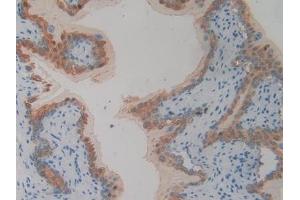 Detection of PLA2R1 in Mouse Vas Deferens Tissue using Polyclonal Antibody to Phospholipase A2 Receptor 1 (PLA2R1) (PLA2R1 anticorps  (AA 1418-1487))