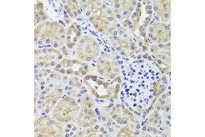 Immunohistochemistry of paraffin-embedded mouse kidney using CGB7 antibody. (CGB7 anticorps  (AA 21-165))