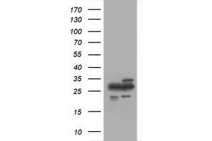 Image no. 1 for anti-Proteasome Subunit alpha 2 (PSMA2) (AA 50-234) antibody (ABIN1491569) (PSMA2 anticorps  (AA 50-234))