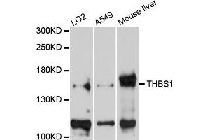 Western blot analysis of extracts of various cells, using THBS1 antibody.