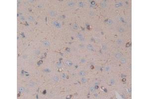 Used in DAB staining on fromalin fixed paraffin- embedded brain tissue