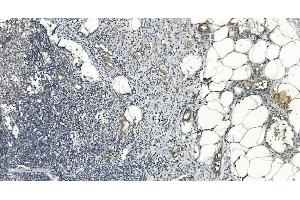 IHC analysis of FLCN using anti-FLCN antibody (ABIN7602491). (FLCN anticorps  (AA 8-551))