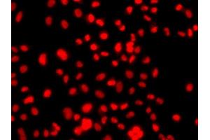 Immunofluorescence analysis of  cells using PRICKLE2 antibody (ABIN6133166, ABIN6146162, ABIN6146163 and ABIN6224046).