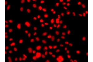 Immunofluorescence analysis of  cells using PRICKLE2 antibody (ABIN6133166, ABIN6146162, ABIN6146163 and ABIN6224046). (PRICKLE2 anticorps  (AA 615-844))