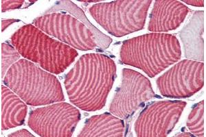 Human Skeletal Muscle (formalin-fixed, paraffin-embedded) stained with TBC1D4 antibody ABIN351486 at 3. (TBC1D4 anticorps  (AA 825-837))