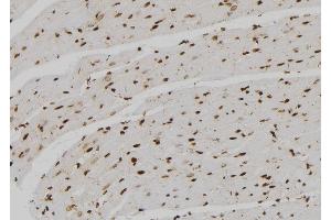 ABIN6257508 and ABIN6273536 at 1/100 staining Rat heart tissue by IHC-P.