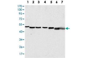 Western blot analysis using TP63 monoclonal antobody, clone 4E5  against A-431 (1), HeLa (2), Jurkat (3), THP-1 (4), NIH/3T3 (5), COS-7 (6) and PC-12 (7) cell lysate.