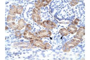 DMRTA2 antibody was used for immunohistochemistry at a concentration of 4-8 ug/ml to stain Epithelial cells of renal tubule (lndicated with Arrows) in Human Kidney. (DMRTA2 anticorps  (C-Term))