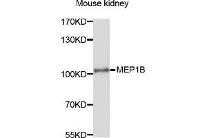 Western blot analysis of extracts of mouse kidney, using MEP1B antibody (ABIN6003791) at 1/1000 dilution. (Meprin B anticorps)