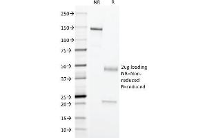 SDS-PAGE Analysis Purified Erythrocyte Specific Mouse Monoclonal Antibody (SFL23. (Erythrocyte Specific Antigen anticorps)