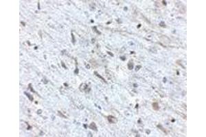 Immunohistochemistry of FKBP15 in mouse brain tissue with FKBP15 antibody at 2.