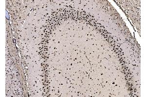 IHC analysis of CPSF6 using anti-CPSF6 antibody (ABIN7601898).