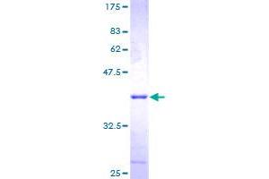 SDS-PAGE (SDS) image for Cyclin-Dependent Kinase 2 Associated Protein 1 (CDK2AP1) (AA 1-115) protein (GST tag) (ABIN1348940)