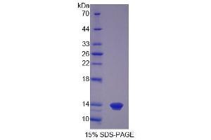 Image no. 1 for S100 Calcium Binding Protein A12 (S100A12) (AA 2-92) protein (His tag) (ABIN4988594)