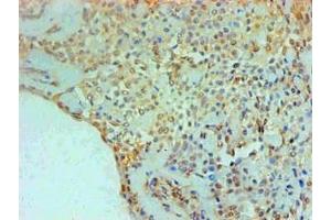 Immunohistochemical of paraffin-embedded Human Breast tissue using ABIN7166415 at dilution of 1:200. (Transglutaminase 2 anticorps)