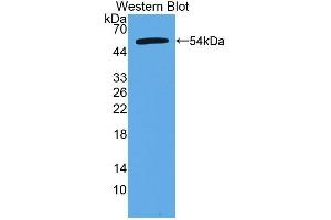 Detection of Recombinant CTRB2, Human using Polyclonal Antibody to Chymotrypsinogen B2 (CTRB2) (CTRB2 anticorps  (AA 34-263))