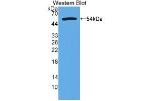 Detection of Recombinant CTRB2, Human using Polyclonal Antibody to Chymotrypsinogen B2 (CTRB2) (CTRB2 anticorps  (AA 34-263))