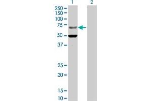 Western Blot analysis of ZNF182 expression in transfected 293T cell line by ZNF182 MaxPab polyclonal antibody. (ZNF182 anticorps  (AA 1-620))