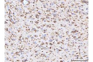 IHC analysis of RBP1 using anti-RBP1 antibody (ABIN7599586). (RBP1 anticorps  (AA 10-135))