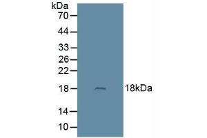 Figure. (Adrenomedullin anticorps  (AA 22-147))