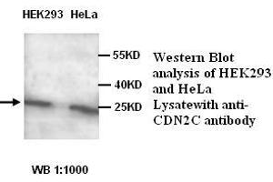 Image no. 1 for anti-Cyclin-Dependent Kinase Inhibitor 2C (p18, Inhibits CDK4) (CDKN2C) antibody (ABIN1575551) (CDKN2C anticorps)