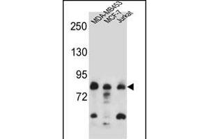AFG3L2 Antibody (N-term) (ABIN657143 and ABIN2846279) western blot analysis in MDA-M,MCF-7,Jurkat cell line lysates (35 μg/lane). (AFG3L2 anticorps  (N-Term))