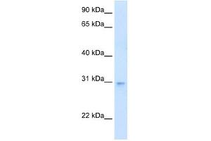 WB Suggested Anti-LDB3 Antibody Titration:  0. (LIM Domain Binding 3 Protein anticorps  (N-Term))