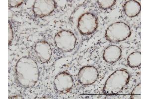 Immunoperoxidase of monoclonal antibody to CHEK2 on formalin-fixed paraffin-embedded human colon.