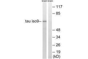 Western blot analysis of extracts from rat brain cells, using Tau (Ab-534/217) antibody. (MAPT anticorps  (Thr217, Thr534))