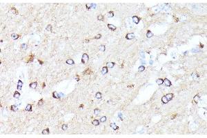 Immunohistochemistry of paraffin-embedded Mouse brain using CCDC6 Polyclonal Antibody at dilution of 1:100 (40x lens).