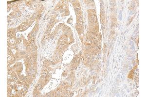 Immunohistochemistry (IHC) image for anti-NF-KappaB2 (/p52) (AA 1-50) antibody (ABIN7795782) (Recombinant NF-KappaB2 (/p52) (AA 1-50) anticorps)