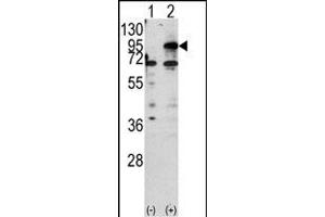 Western blot analysis of CPT1B (arrow) using rabbit polyclonal CPT1B Antibody (C-term) (ABIN389106 and ABIN2839296). (CPT1B anticorps  (C-Term))