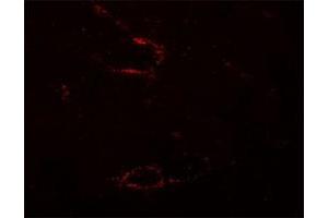 Immunofluorescencent staining of mouse skeletal muscle cells with SYNPO2L polyclonal antibody  at 5 ug/mL. (SYNPO2L anticorps  (N-Term))