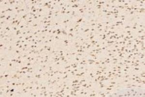 Immunohistochemistry analysis of paraffin-embedded mouse striatum using,IRX1 (ABIN7074377) at dilution of 1: 4400