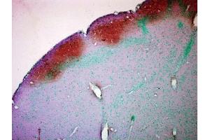 Immunohistochemistry analysis using Mouse Anti-CaMKII Monoclonal Antibody, Clone 22B1 . (CAMKII gamma anticorps  (Atto 390))