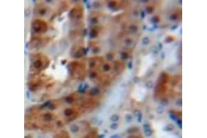 Used in DAB staining on fromalin fixed paraffin-embedded Kidney tissue (Calreticulin anticorps  (AA 18-193))