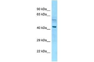 WB Suggested Anti-Nap1l4 Antibody Titration: 1. (NAP1L4 anticorps  (N-Term))