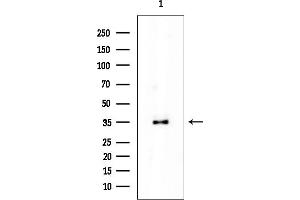 anti-Immunoglobulin (CD79A) Binding Protein 1 (IGBP1) antibody