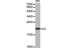 Western blot analysis of extracts of 293 cell line, using IL6 antibody. (IL-6 anticorps)