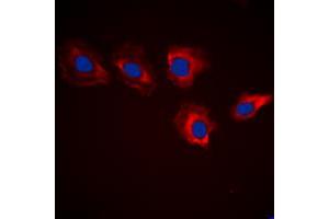 Immunofluorescent analysis of MARK3 staining in HeLa cells. (MARK3 anticorps  (N-Term))