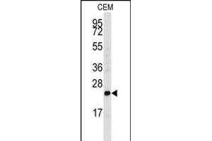 Western blot analysis of anti-FGF4 Antibody (C-term) (ABIN392776 and ABIN2842218) in CEM cell line lysates (35 μg/lane). (FGF4 anticorps  (C-Term))