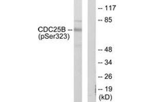 Western blot analysis of extracts from NIH-3T3 cells treated with PMA 125ng/ml 30', using CDC25B (Phospho-Ser323) Antibody.