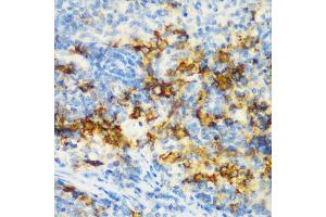 Immunohistochemistry of paraffin-embedded rat spleen using CD3D antibody (ABIN5970580) at dilution of 1/200 (40x lens). (CD3D anticorps)