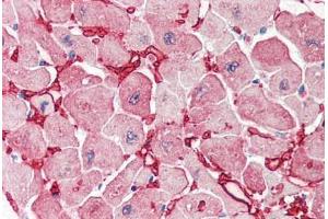 Human Heart (formalin-fixed, paraffin-embedded) stained with GOT1 antibody ABIN337132 at 2. (GOT1 anticorps  (AA 157-167))