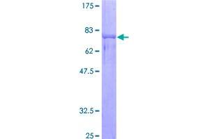 Image no. 1 for Neuro-Oncological Ventral Antigen 1 (NOVA1) (AA 1-507) protein (GST tag) (ABIN1312823)
