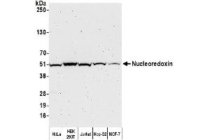 Western Blotting (WB) image for anti-Nucleoredoxin (NXN) (AA 385-435) antibody (ABIN7449243)